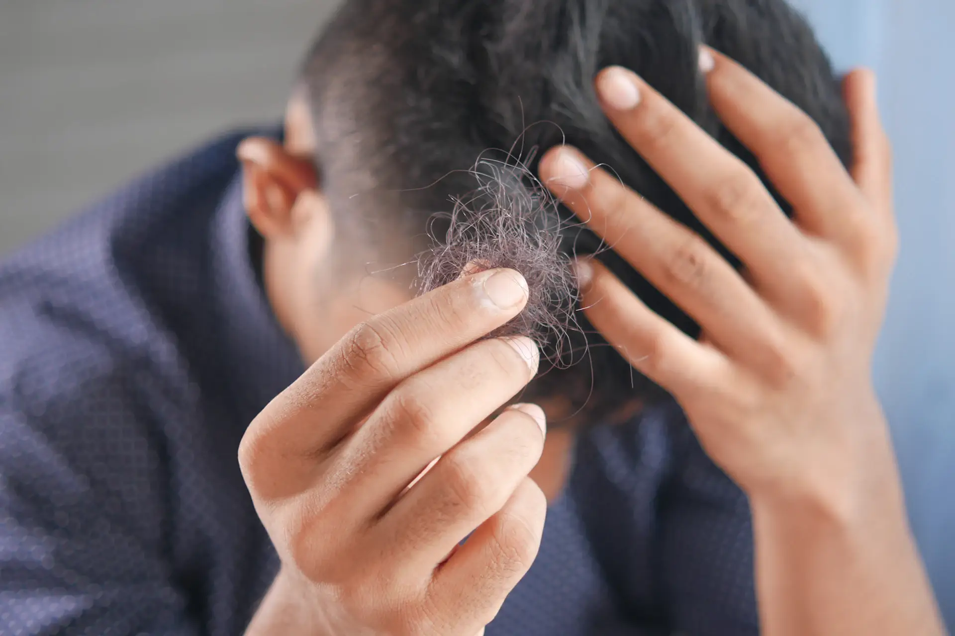 Homme observant une chute de cheveux